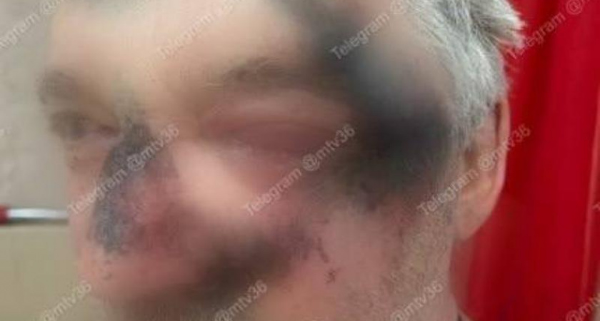 Внедорожник сбил врача с женой на пешеходном переходе в Воронеже