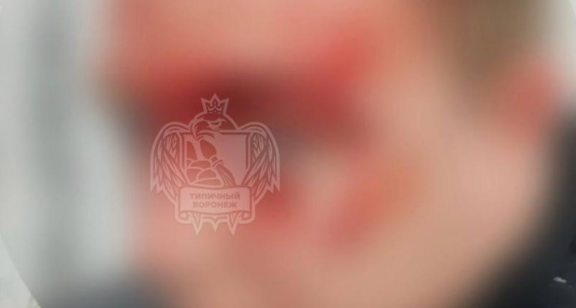 Плитка упала на голову жителю ЖК "Скандинавия" в Воронеже