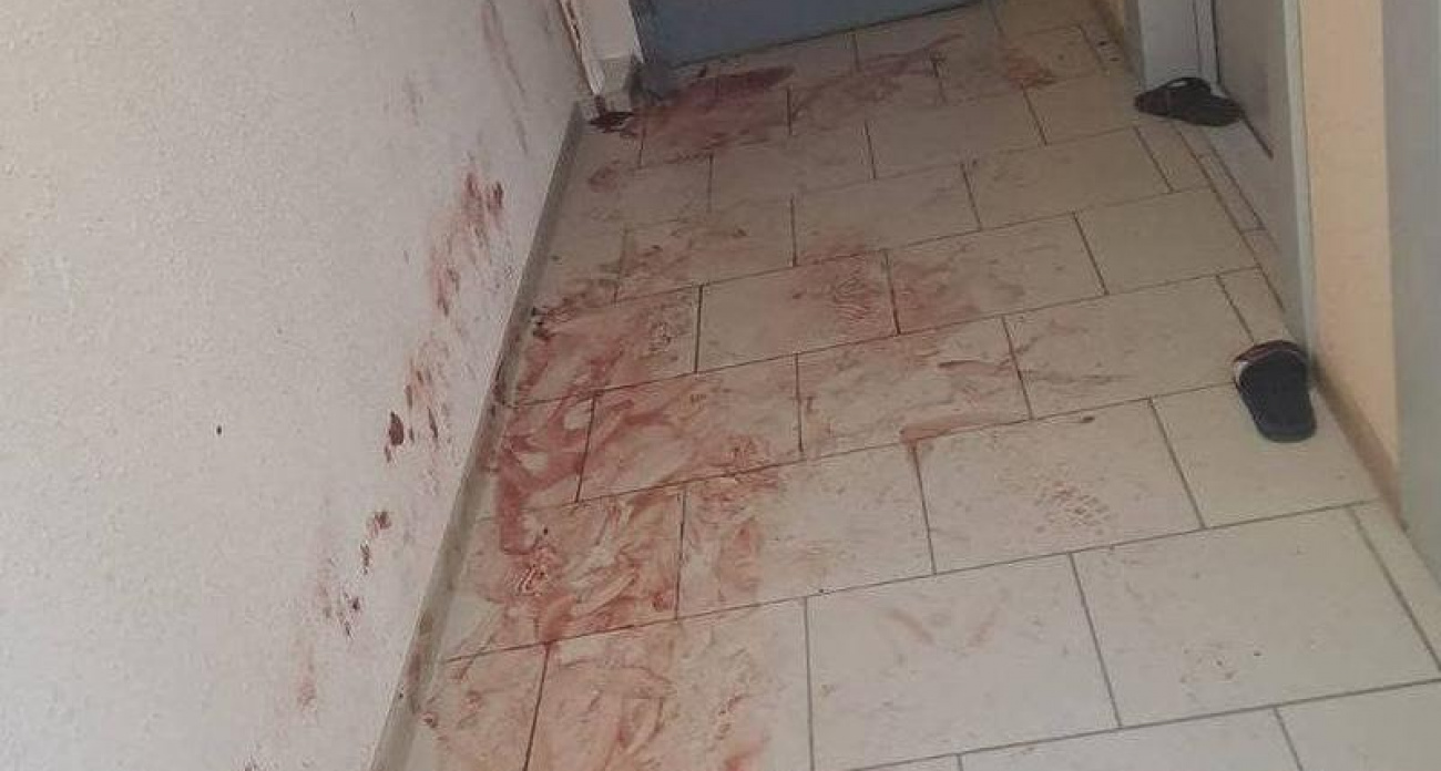 Житель воронежского ЖК устроил кровавый погром в квартире и подъезде