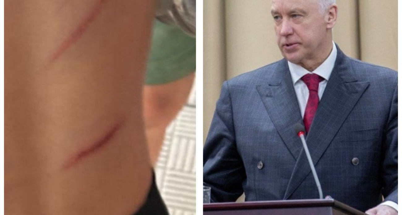 Бастрыкин взял на контроль дело о детях, спавших на одном матрасе и выбегавших голыми из подъезда в Воронеже