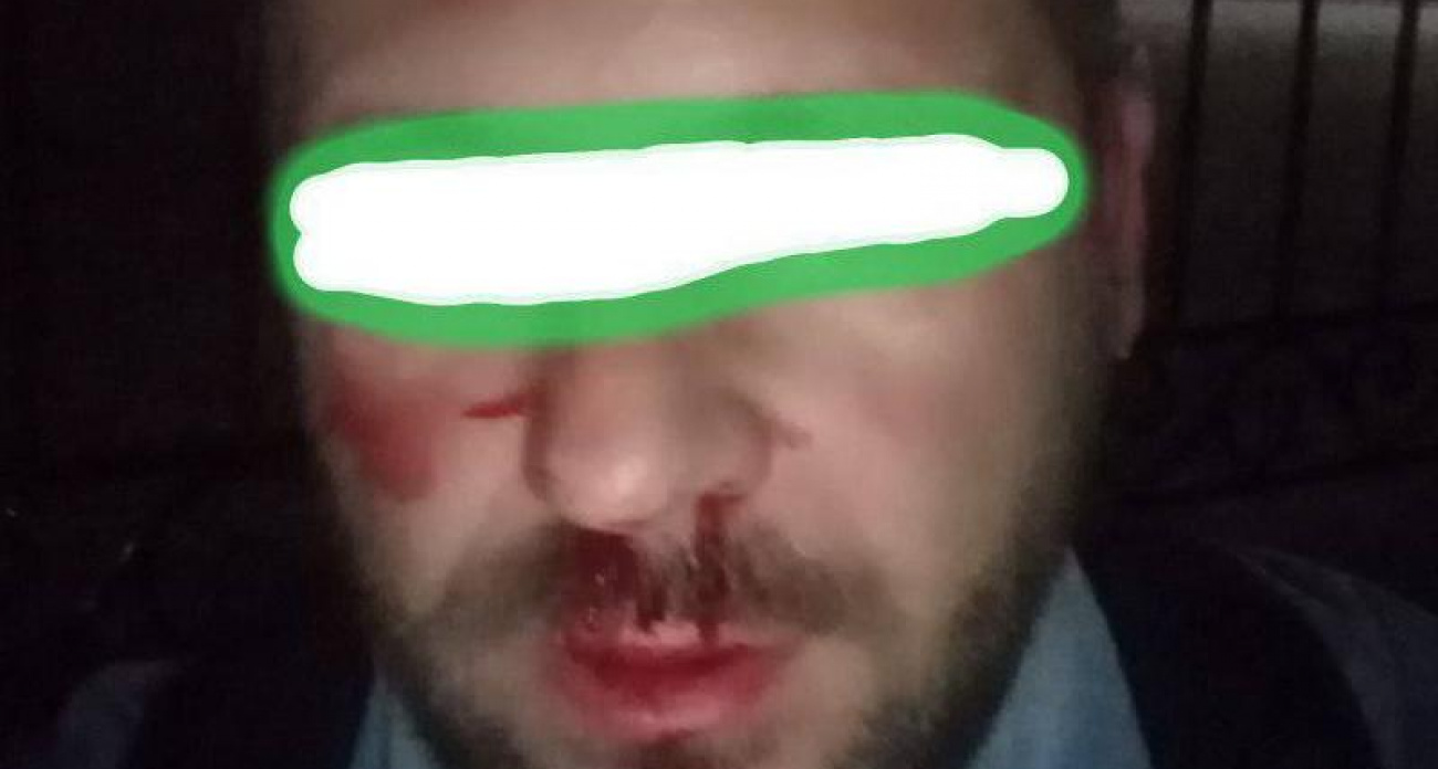 Наблюдателя от самовыдвиженца избили на выборах в Воронежской области: нейрохирурги отпустили домой